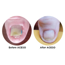 Load image into Gallery viewer, Famous Names Aceso Step One 14.8ml