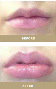 The Powerhouse Lip Plumper